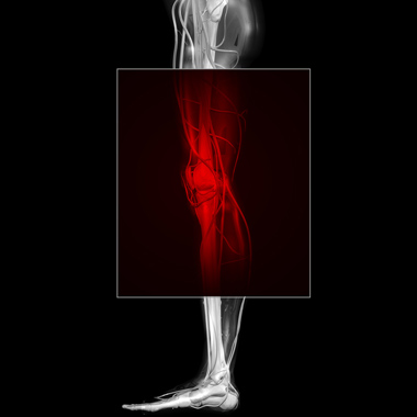 Nehogy a lábaidba kerüljön! Alsó végtagi artériás, vénás keringési Doppler vizsgálat a trombózis, üszkösödés, lábszárfekély ellen 50% kedvezménnyel!