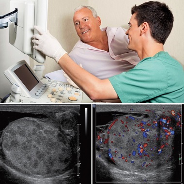 Szűrőcsomag férfiaknak: hasi- és kismedencei, valamint here ultrahang vizsgálat a MyDoctor Egészségközpontban.