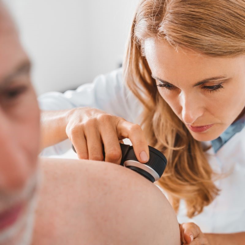 Dermatoszkópos melanoma szűrés a teljes testen a Budai Magánorvosi Centrumban előleg