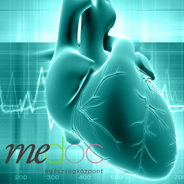 Átfogó kardiológiai szakorvosi szűrés: EKG + vérnyomásmérés + fizikális vizsgálat + terheléses EKG. Medibon ár: 18.000 Ft.